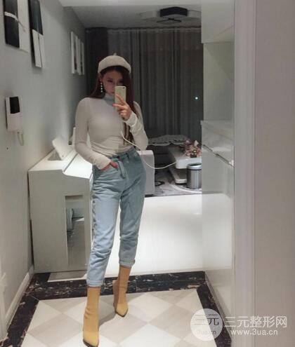 自體脂肪豐胸案例