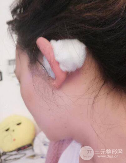 耳軟骨隆鼻全過程及術(shù)后果分享