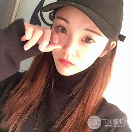 下頜角磨骨整形全過(guò)程分享，附上術(shù)后恢復(fù)照片~