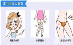 彩光脫毛副作用?彩光脫毛有副作用嗎?