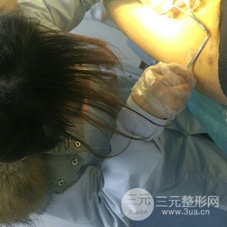 大腿抽脂果好到不行、瘦十厘米不是問題