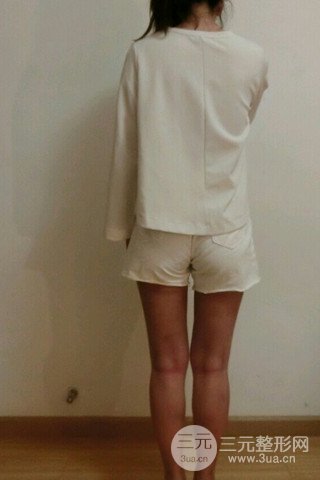 大腿抽脂果好到不行、瘦十厘米不是問題