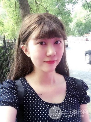 深圳臻希美詳細部自體脂肪填充果對比超明X