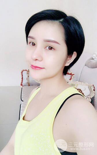 做了隆鼻整形隆鼻之后，短發(fā)女孩也可以性感！