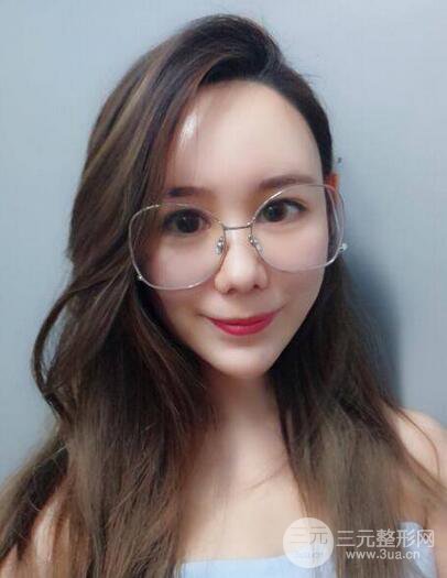 全臉自體脂肪填充，填充不飽滿還可以瘦臉_真人案例