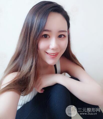 全臉自體脂肪填充，填充不飽滿還可以瘦臉_真人案例