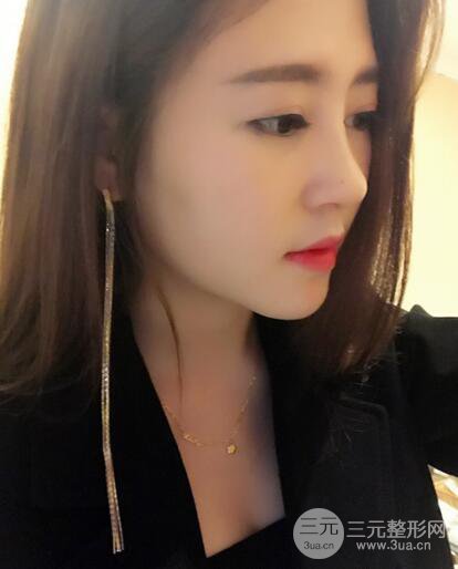 膨體隆鼻術后恢復果圖_全過程解密