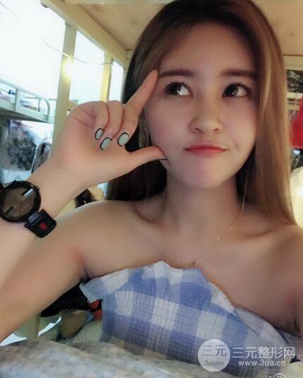 膨體隆鼻術后恢復果圖_全過程解密