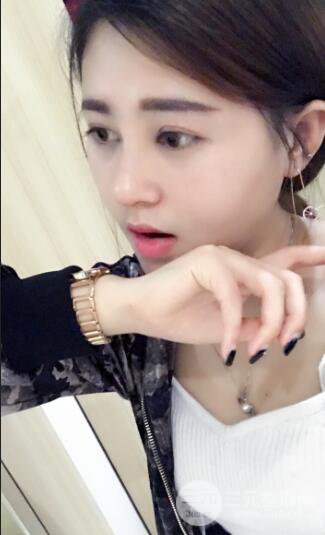 膨體隆鼻術后恢復果圖_全過程解密