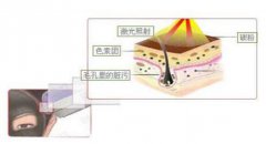 成都鐳射黑臉娃娃多少錢?價格多少?