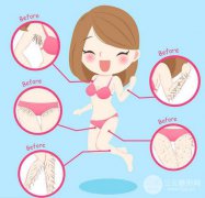 比基尼脫毛需要脫幾次？哪種方法好？