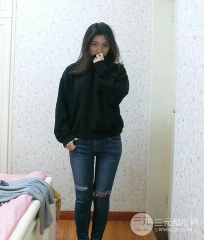 大腿吸脂后恢復(fù)過(guò)程及術(shù)后照片分享【圖片】