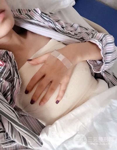 假體隆胸手術恢復記錄，豐滿大胸不是夢