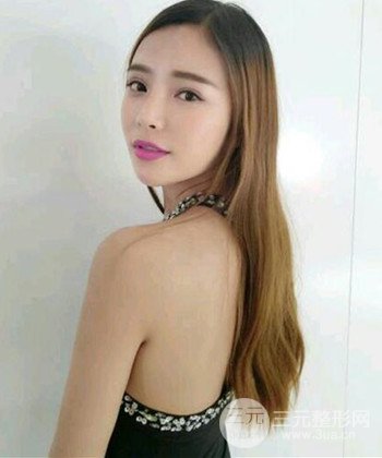 模特做隆鼻整形真實日記分享,附上恢復(fù)過程圖