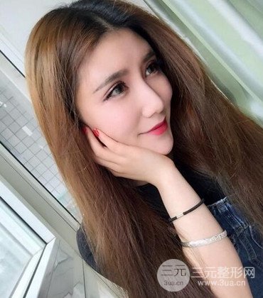 網(wǎng)絡(luò)主播做自體脂肪豐太陽穴真實案例分享，果杠杠的