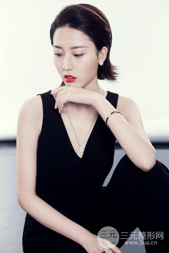 蘇州切開雙眼皮恢復(fù)果大分享，變化不止一點點