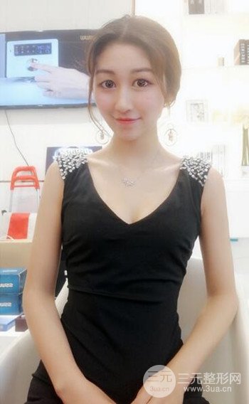 廣州隆鼻整形真實恢復期圖片，擁有精致美鼻不是夢