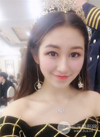 廣州隆鼻整形真實恢復期圖片，擁有精致美鼻不是夢