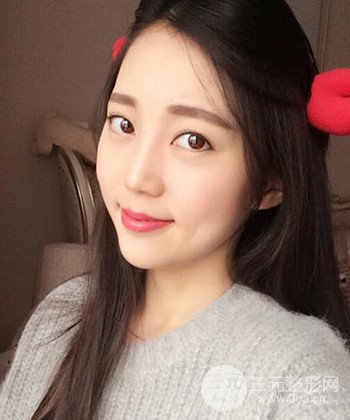 深圳內(nèi)切去眼袋+硅膠墊下巴真實案例恢復果圖