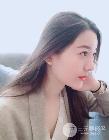 廣州隆鼻整形+全臉自體脂肪填充真人案例果分享