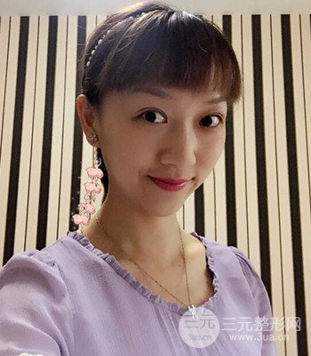 北京雙眼皮失敗修復手術(shù)日記分享，附上前后對比照片