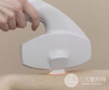 激光脫毛之后還會長嗎？脫毛之后會反彈嗎？