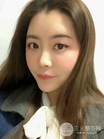 主播在深圳美臣做了自體脂肪全臉填充手術(shù)日記分享