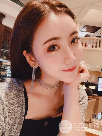 主播在深圳美臣做了自體脂肪全臉填充手術(shù)日記分享