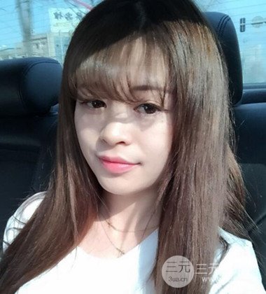 上海雙眼皮手術(shù)真人案例恢復(fù)過程分享