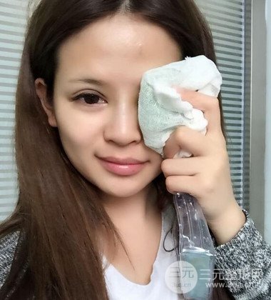 上海雙眼皮手術(shù)真人案例恢復(fù)過程分享