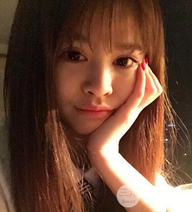 上海雙眼皮手術(shù)真人案例恢復(fù)過程分享