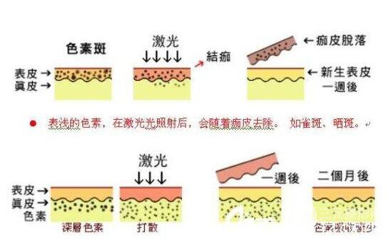 光子嫩膚價(jià)格是多少