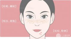 果酸換膚會(huì)反彈嗎?緩解后應(yīng)該如何護(hù)理?