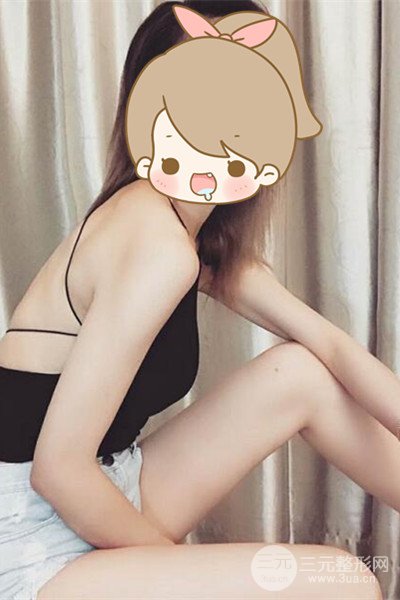 梨型身材做了大腿吸脂之后果超明X,吸脂恢復過程分享