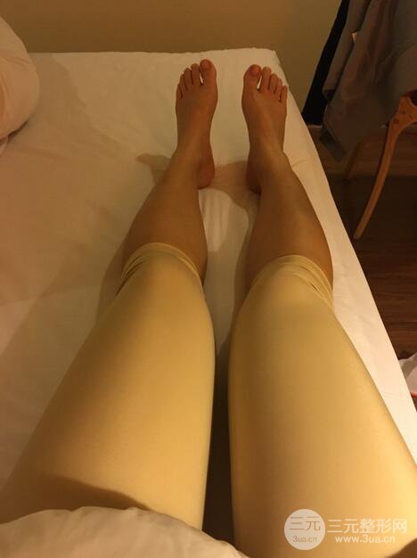 北京自體脂肪隆胸手術(shù)日記分享，豐胸術(shù)后恢復(fù)果圖