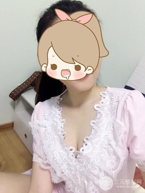 北京自體脂肪隆胸手術(shù)日記分享，豐胸術(shù)后恢復(fù)果圖