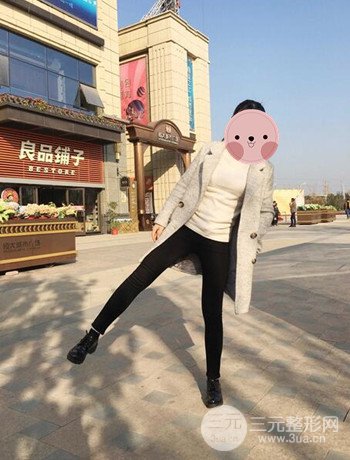 吸脂瘦大腿手術(shù)經(jīng)歷分享，纖細雙腿不再是夢