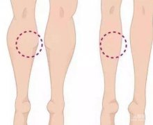 注射瘦臉一針多少錢?果好不好?