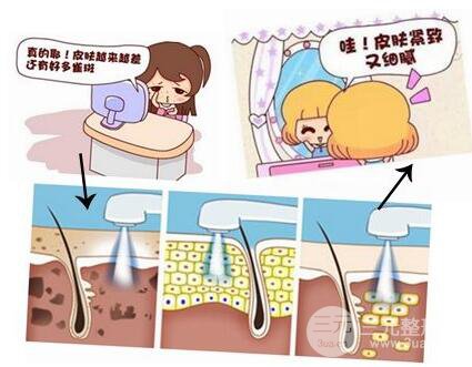 光子嫩膚價格是多少 適合哪些人群