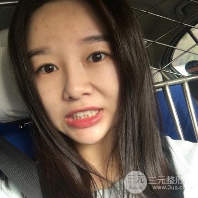 做了牙齒冷光美白果很棒，綻放美麗笑容