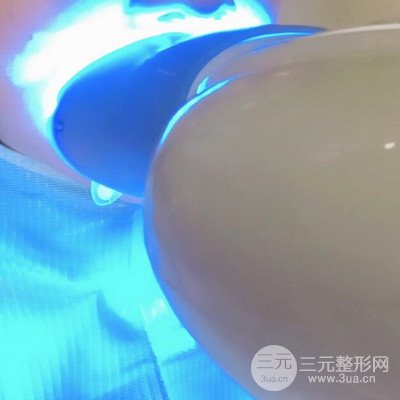 做了牙齒冷光美白果很棒，綻放美麗笑容