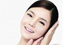 電波l皮多少錢(qián)?面部電波l皮多少錢(qián)?