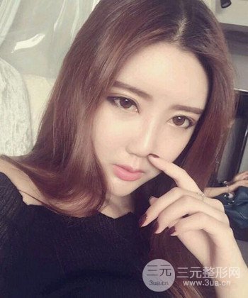 全臉自體脂肪填充手術(shù)日記分享，改良臉型年輕十歲