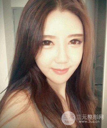 全臉自體脂肪填充手術(shù)日記分享，改良臉型年輕十歲