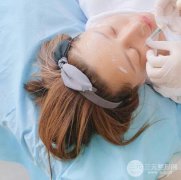 瑞蘭玻尿酸注射蘋果肌術(shù)后果圖片