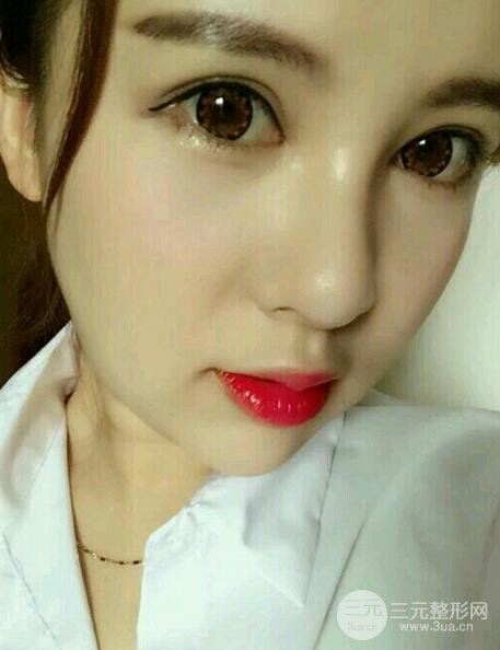 隆鼻整形手術(shù)個人經(jīng)歷分享,精致小翹鼻不是夢