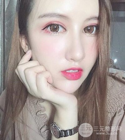 隆鼻整形手術(shù)個人經(jīng)歷分享,精致小翹鼻不是夢