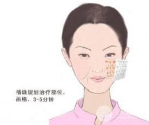 塑m極危害有哪些?副作用?