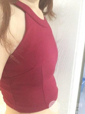 假體隆胸術(shù)后成功擺脫小學(xué)生身材，立現(xiàn)性感身材