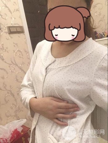 假體隆胸術(shù)后成功擺脫小學(xué)生身材，立現(xiàn)性感身材